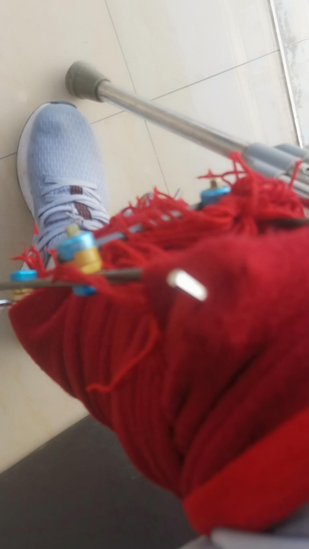 比亚迪宋MAX DM-i xdm有没有知道 腿受伤了 驾照能不能换  右小腿骨折 有外固定支架 驾证到期能不能办理换证