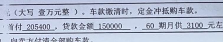 奥迪A5 我这个总价是391400吗