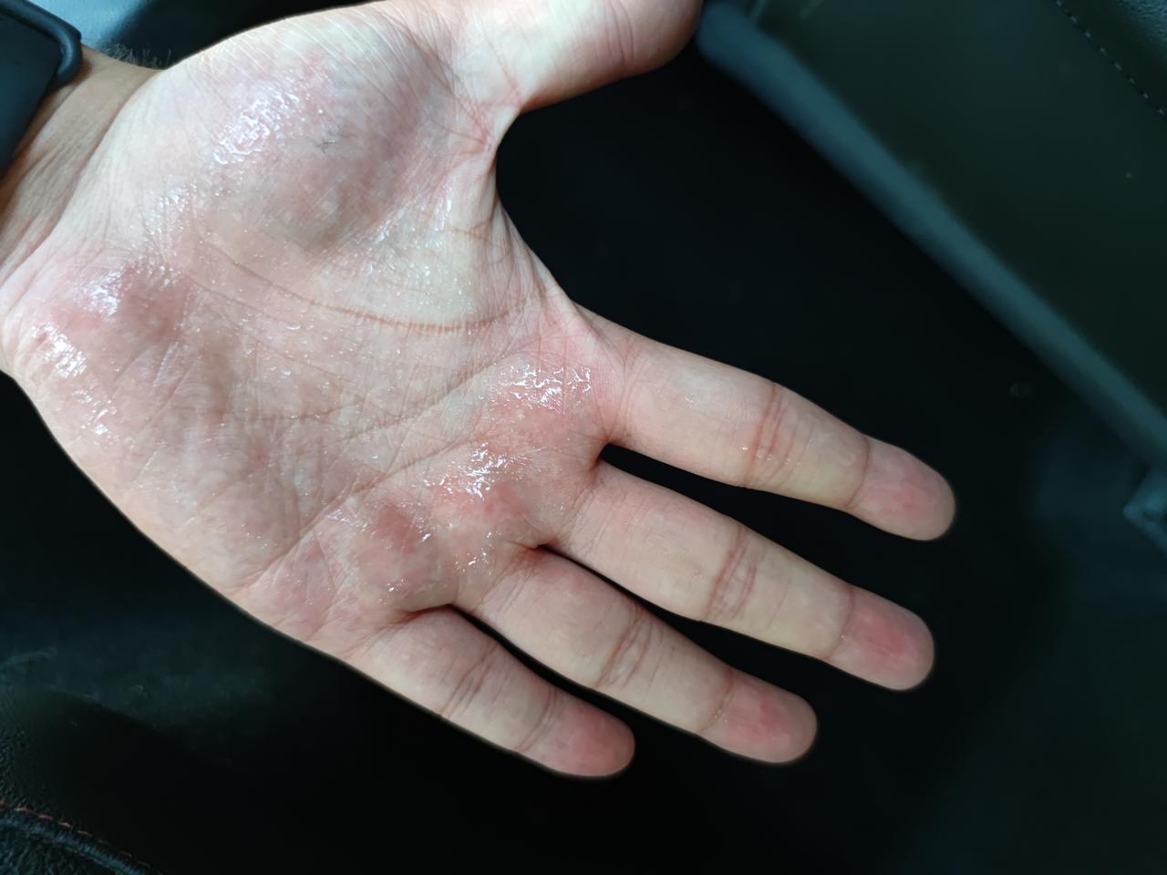 大众宝来 连续下了几天雨，后排最左边这个位置怎么都是水