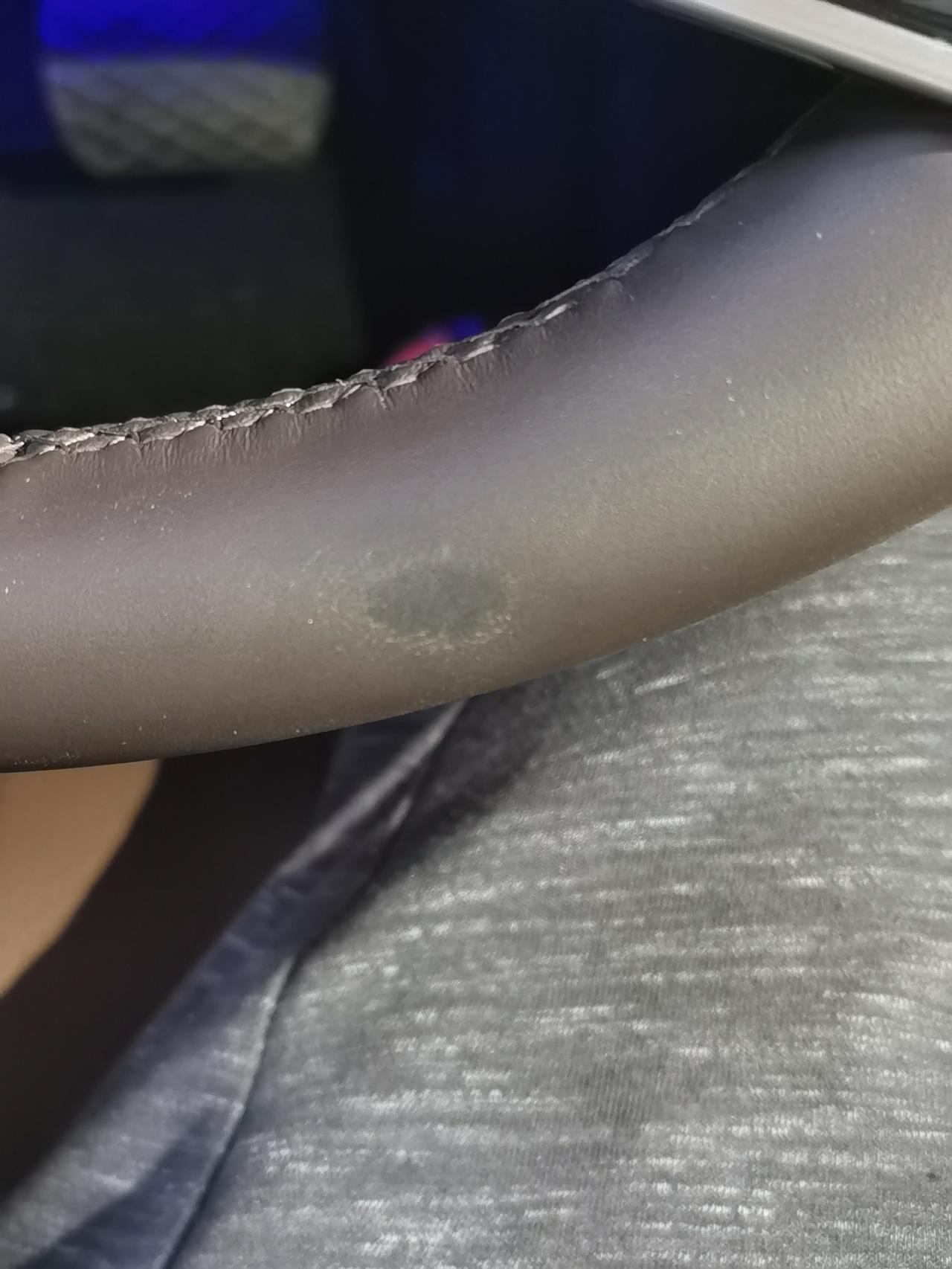 奔驰E级 尊贵的E300车主！你们方向盘脱皮吗，我的新车才买3个月就掉皮。求问下你们有这情况吗？