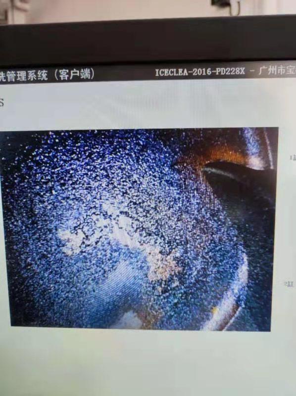 宝马3系 娘的，新车不到一年，12000公里，两个缸全是积碳，两个缸正常？怠速间歇性抖动，抖的像癫痫？四儿子硬是说查不出