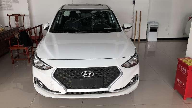 veloster飞思-帮我看看这是什么车
