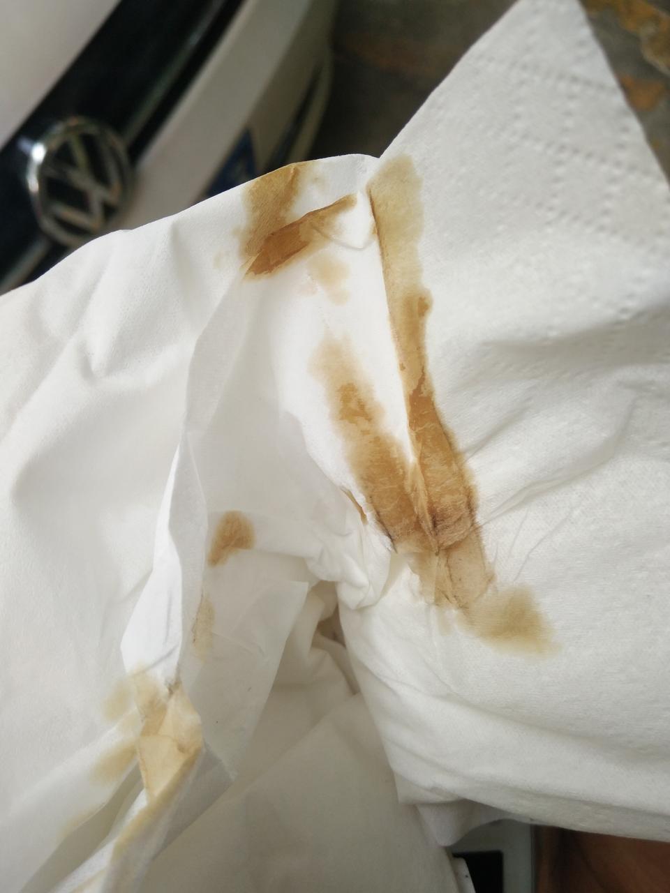凌渡-我这个机油算不算黑了  老铁些