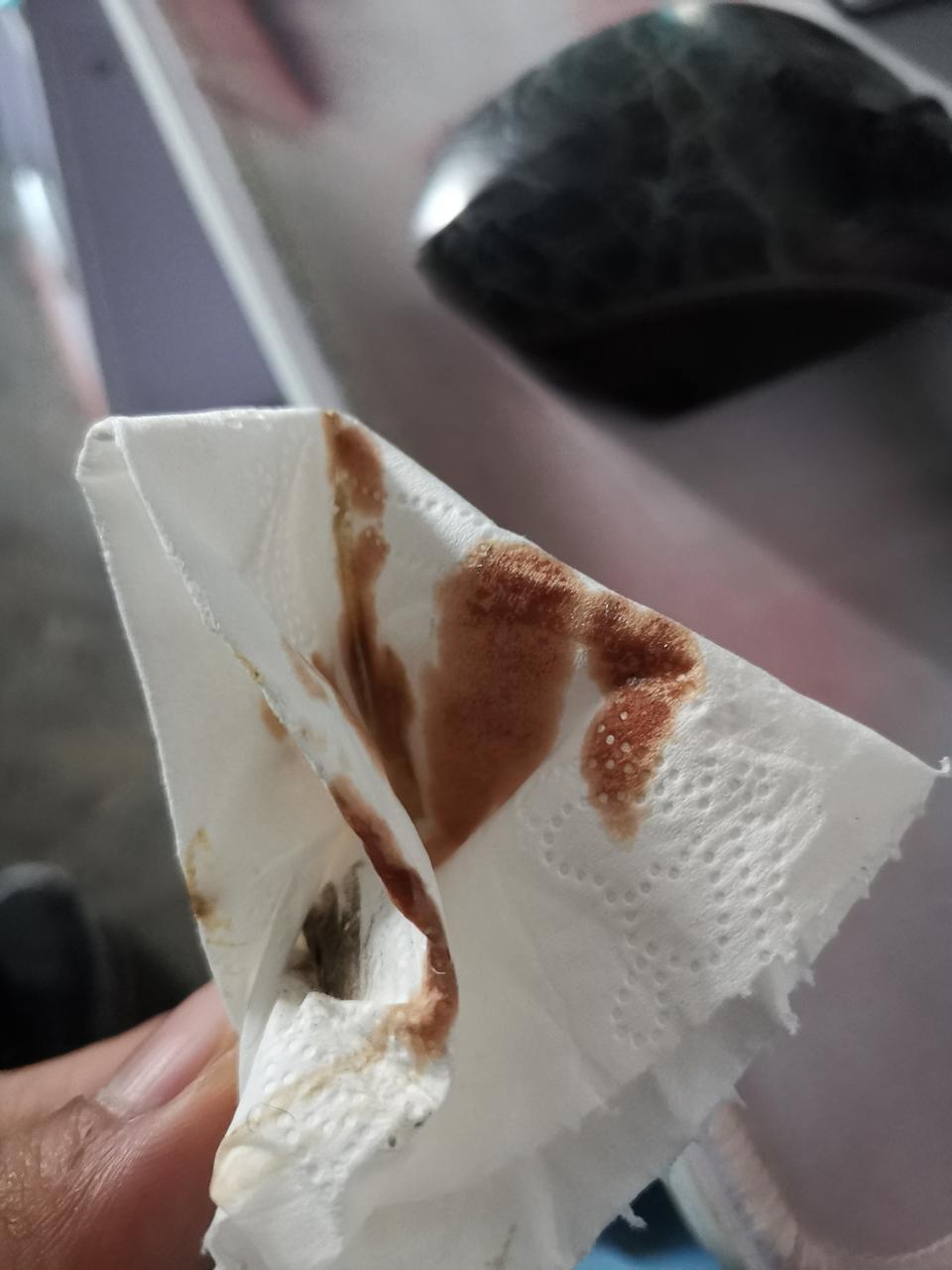 远景x6-16款吉利X6，上次28500保养，现在32000不到，机油现在是这个样子，影响不影响使用？需要更换么？求解